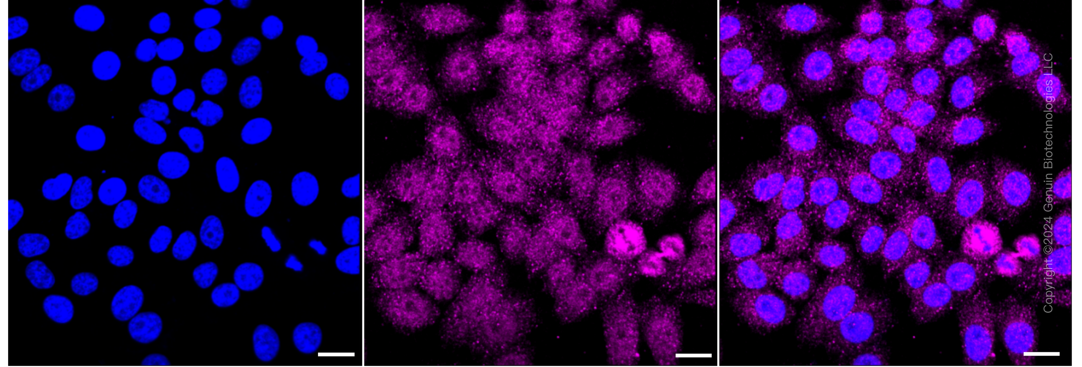KD-Validated Anti-PFKM Rabbit Monoclonal Antibody ABG1265