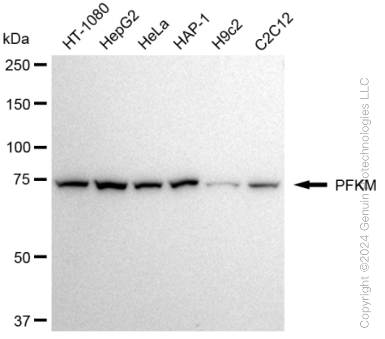 KD-Validated Anti-PFKM Rabbit Monoclonal Antibody ABG1265
