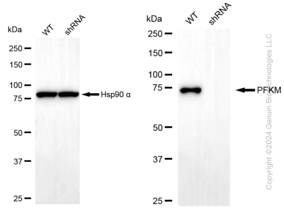 KD-Validated Anti-PFKM Rabbit Monoclonal Antibody ABG1265