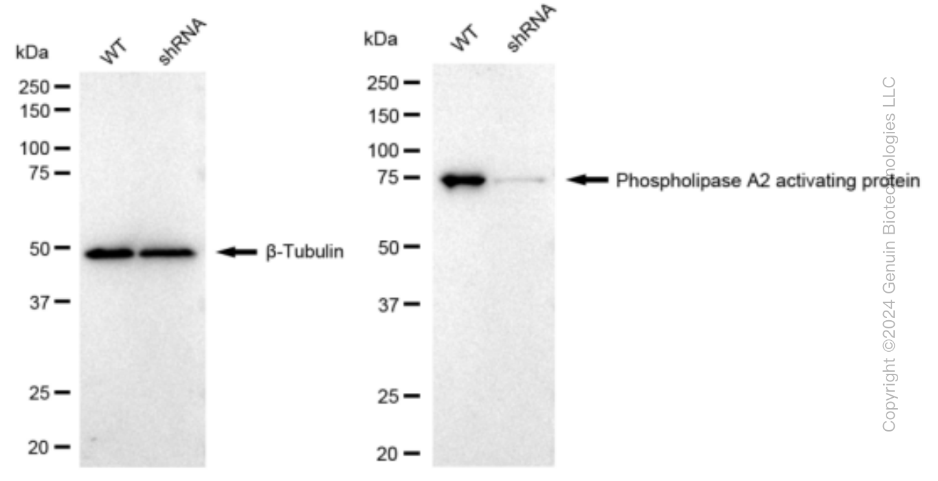 KD-Validated Anti-Phospholipase A2 activating protein Rabbit Monoclonal Antibody ABG1267