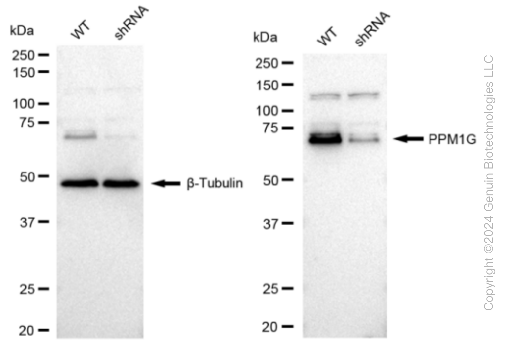 KD-Validated Anti-PPM1G Rabbit Monoclonal Antibody ABG1268