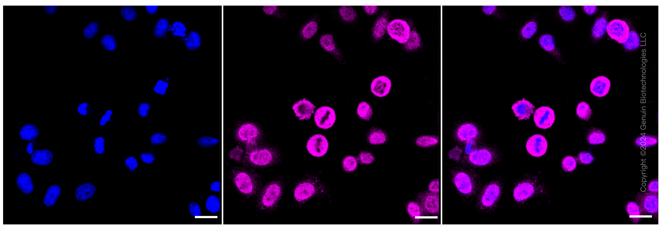 KD-Validated Anti-Protein arginine methyltransferase 7 Rabbit Monoclonal Antibody ABG1273