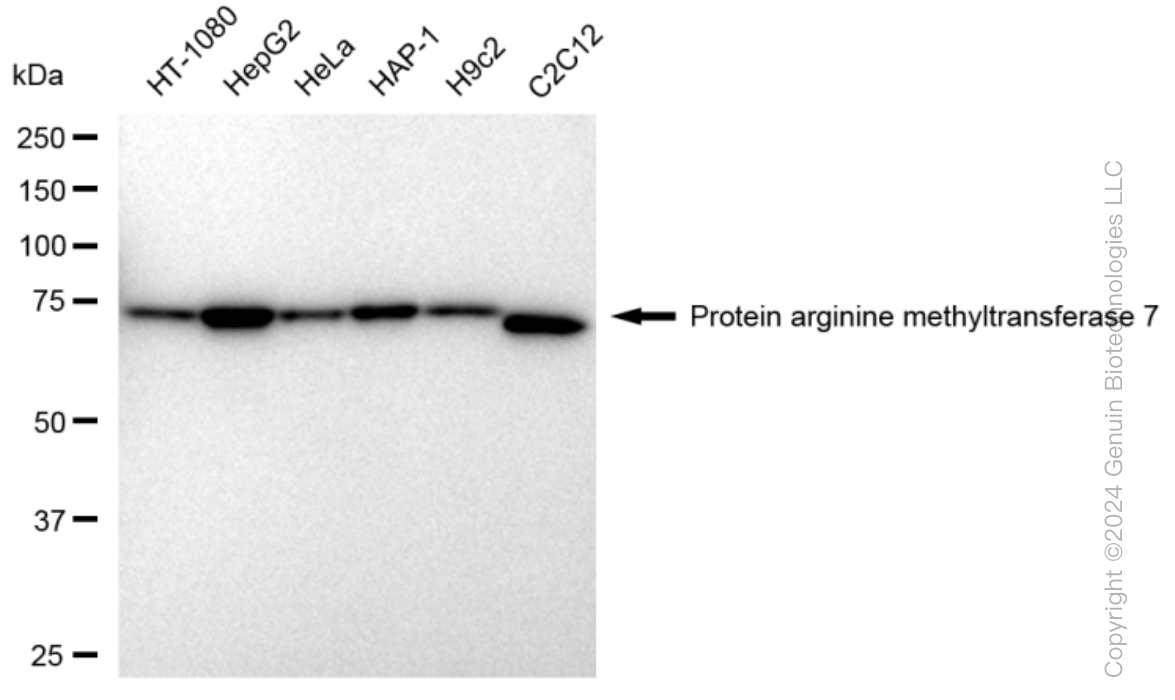 KD-Validated Anti-Protein arginine methyltransferase 7 Rabbit Monoclonal Antibody ABG1273