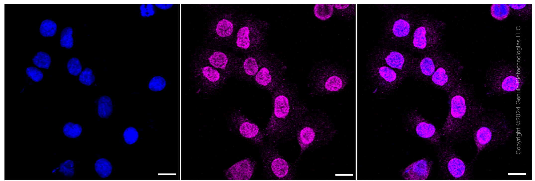 KD-Validated Anti-PVR Rabbit Monoclonal Antibody ABG1276
