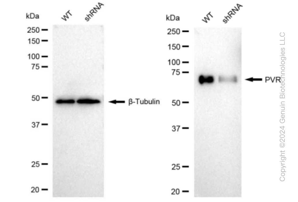 KD-Validated Anti-PVR Rabbit Monoclonal Antibody ABG1276