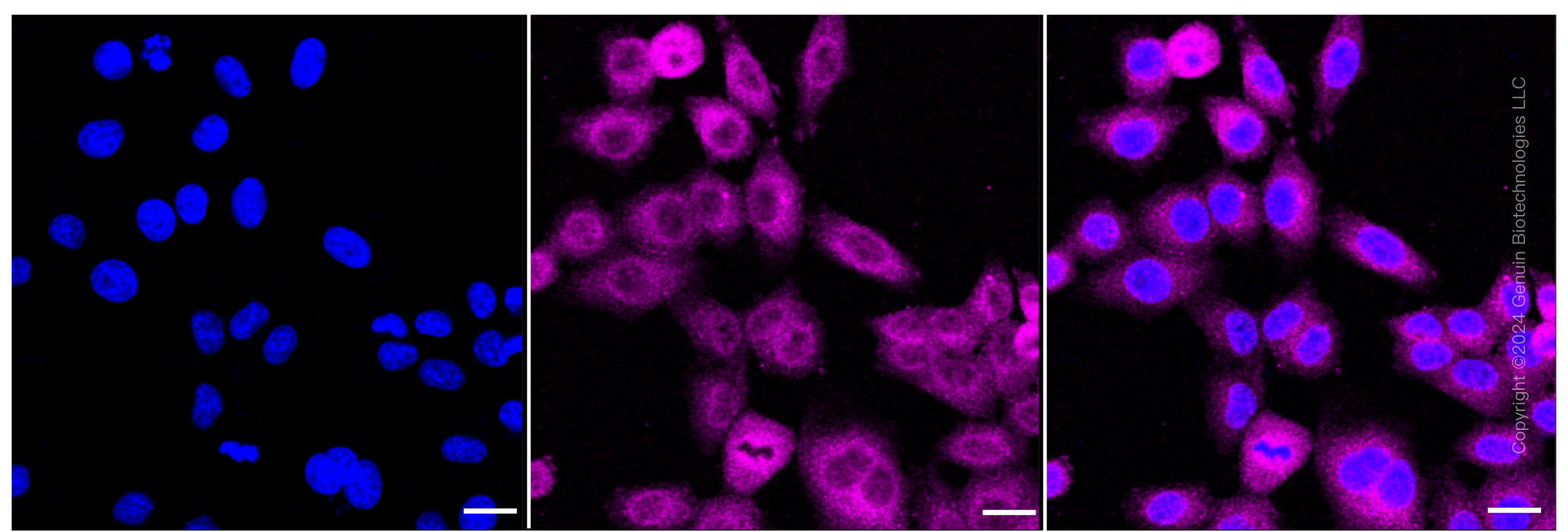 KD-Validated Anti-Raf1 Rabbit Monoclonal Antibody ABG1278