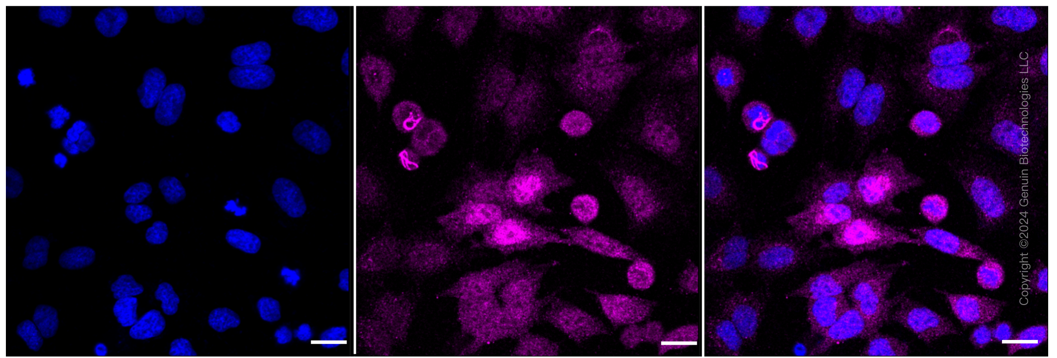KD-Validated Anti-Phospho-RSK1(S380) Rabbit Monoclonal Antibody ABG1281