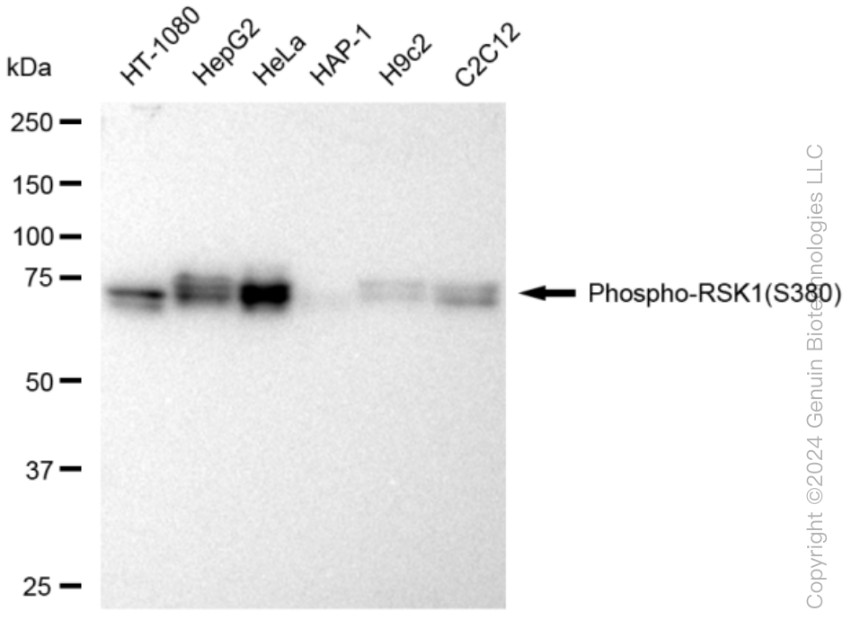 KD-Validated Anti-Phospho-RSK1(S380) Rabbit Monoclonal Antibody ABG1281