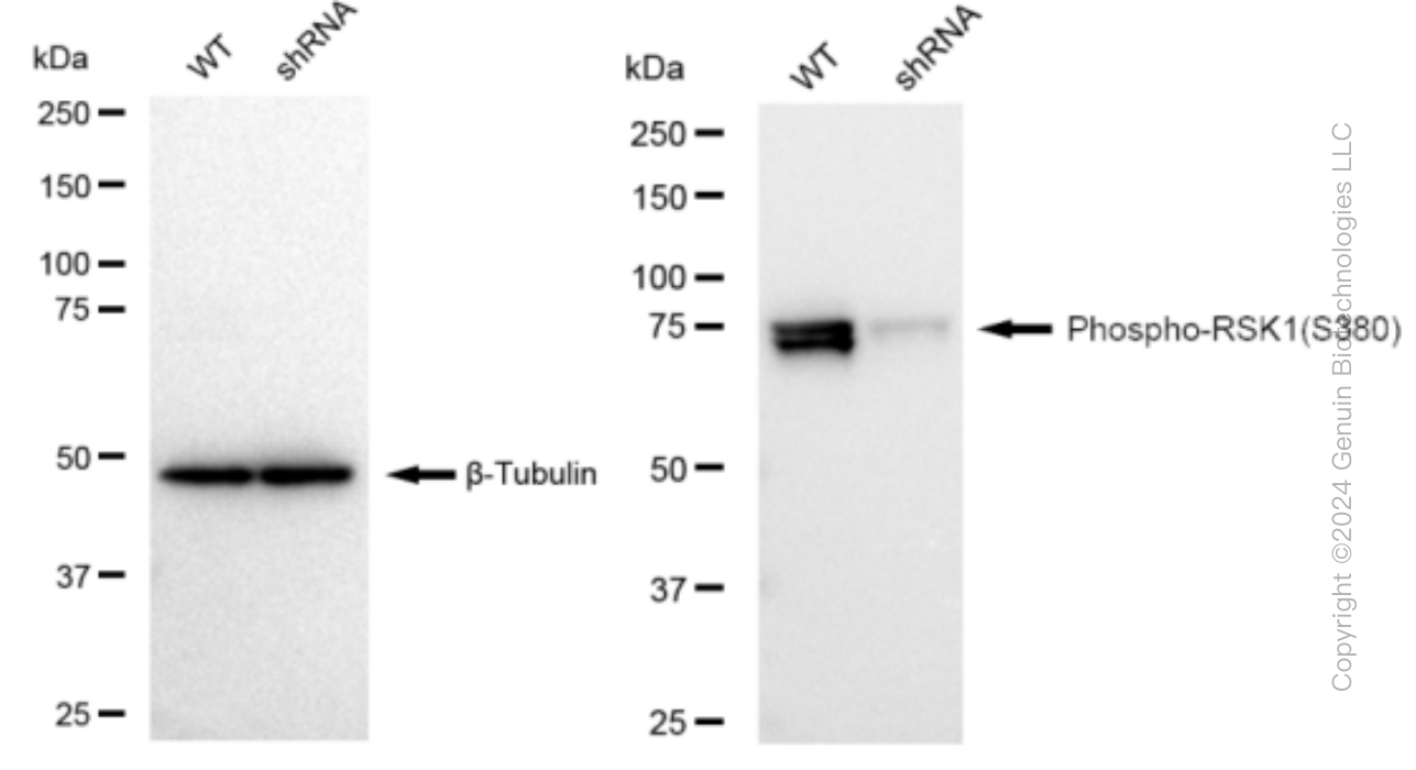 KD-Validated Anti-Phospho-RSK1(S380) Rabbit Monoclonal Antibody ABG1281