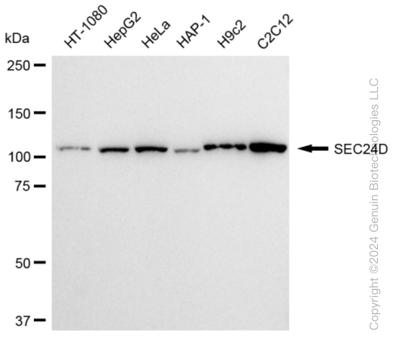 KD-Validated Anti-SEC24D Rabbit Monoclonal Antibody ABG1283