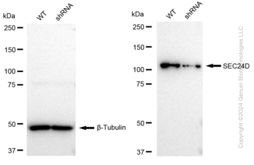 KD-Validated Anti-SEC24D Rabbit Monoclonal Antibody ABG1283