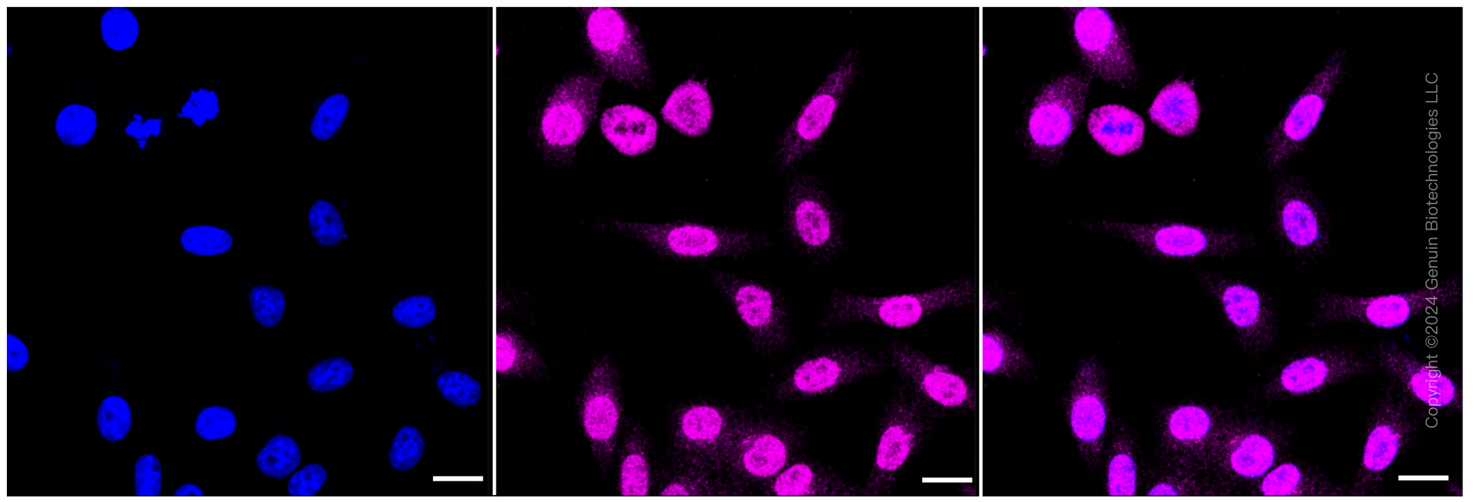 KD-Validated Anti-SMAD5 Rabbit Monoclonal Antibody ABG1284