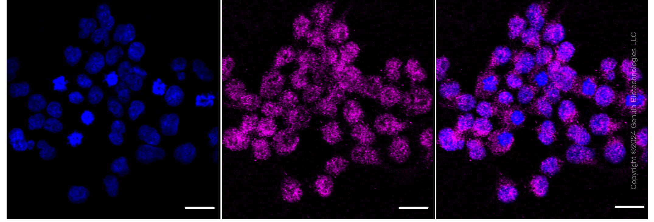 KD-Validated Anti-Stromal interaction molecule 1 Rabbit Monoclonal Antibody ABG1285