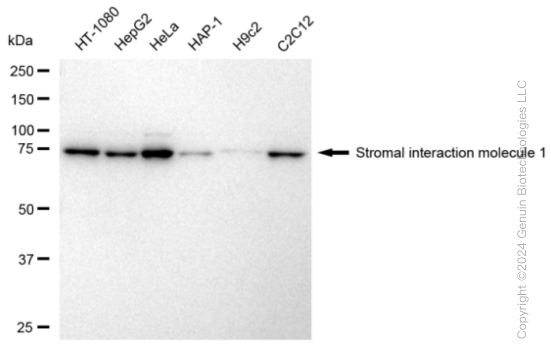 KD-Validated Anti-Stromal interaction molecule 1 Rabbit Monoclonal Antibody ABG1285