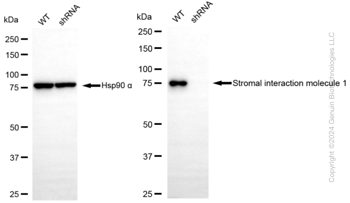 KD-Validated Anti-Stromal interaction molecule 1 Rabbit Monoclonal Antibody ABG1285