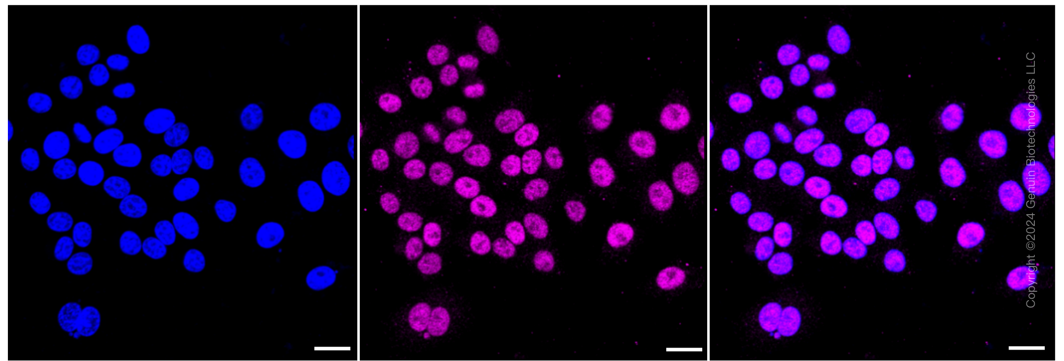 KD-Validated Anti-TEAD1 Rabbit Monoclonal Antibody ABG1289