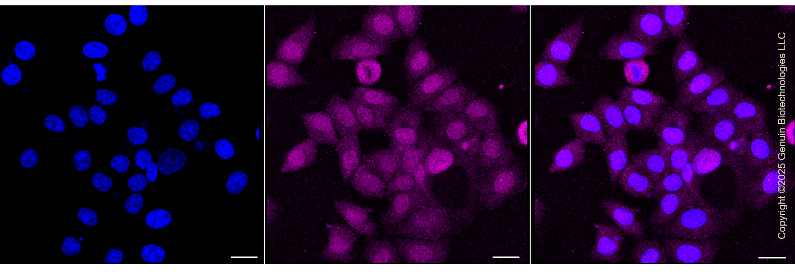 KD-Validated Anti-TRNA Methyltransferase 2 Homolog Rabbit Monoclonal Antibody ABG1296