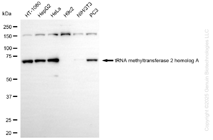 KD-Validated Anti-TRNA Methyltransferase 2 Homolog Rabbit Monoclonal Antibody ABG1296