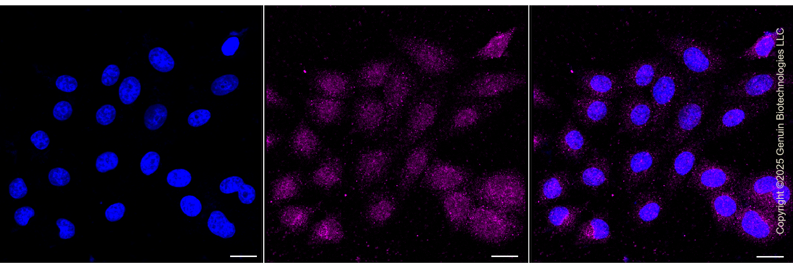KD-Validated Anti-GFPT1 Rabbit Monoclonal Antibody ABG1298