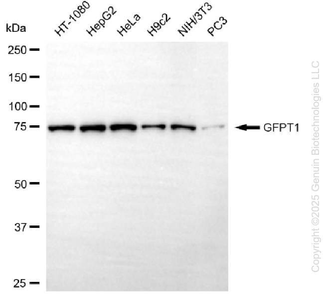 KD-Validated Anti-GFPT1 Rabbit Monoclonal Antibody ABG1298