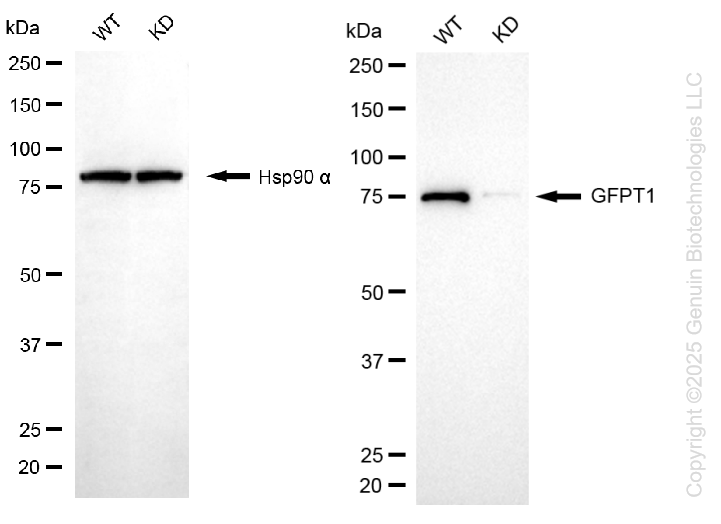 KD-Validated Anti-GFPT1 Rabbit Monoclonal Antibody ABG1298