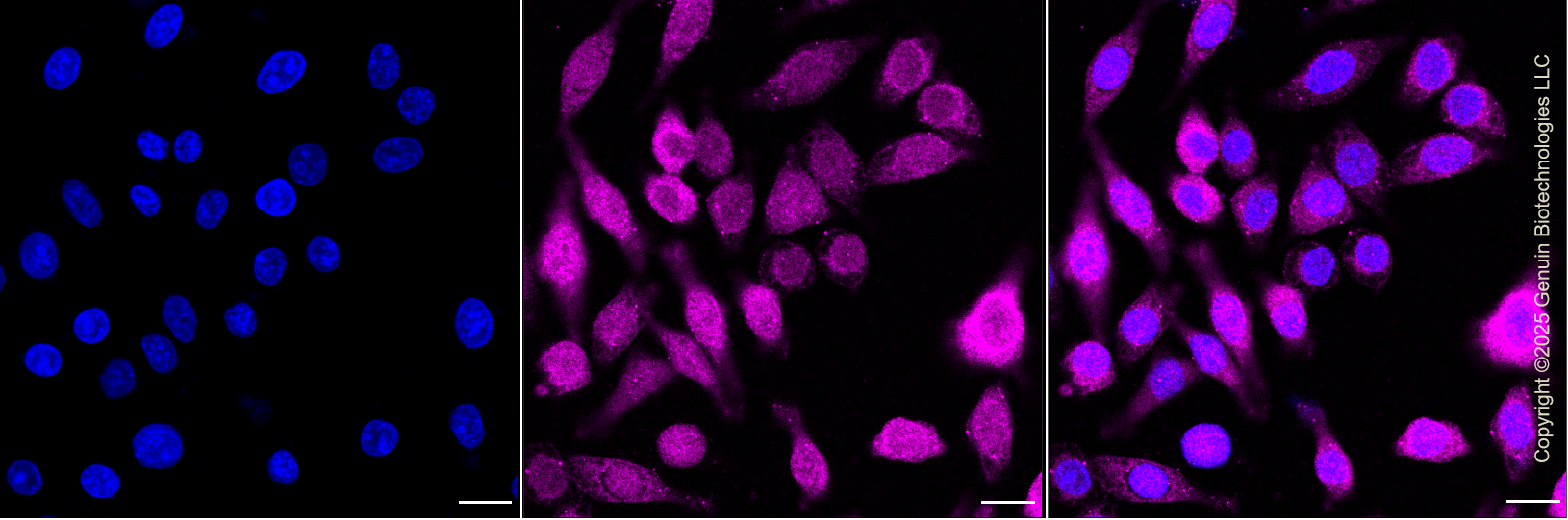 KD-Validated Anti-Enolase 1 Rabbit Monoclonal Antibody ABG1301