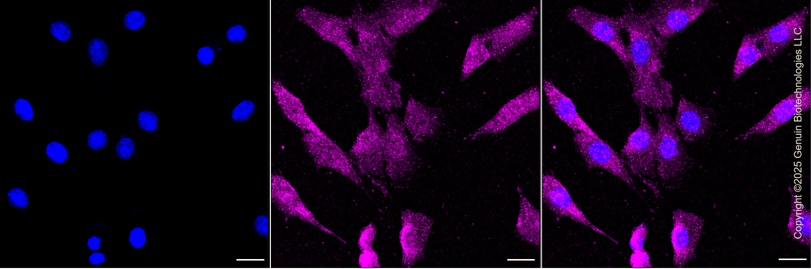 KD-Validated Anti-Protein Tyrosine Kinase 2 Rabbit Monoclonal Antibody ABG1302