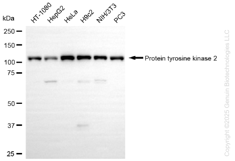 KD-Validated Anti-Protein Tyrosine Kinase 2 Rabbit Monoclonal Antibody ABG1302