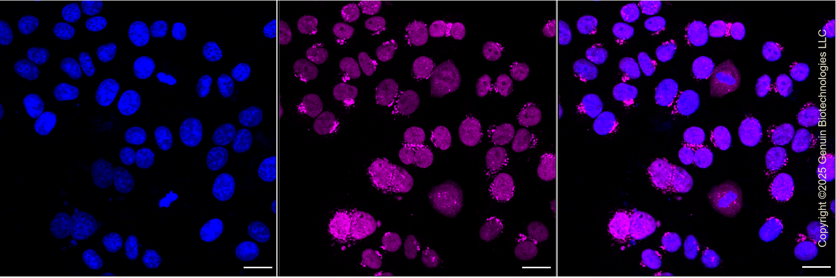 KD-Validated Anti-Chromobox Rabbit Monoclonal Antibody ABG1303