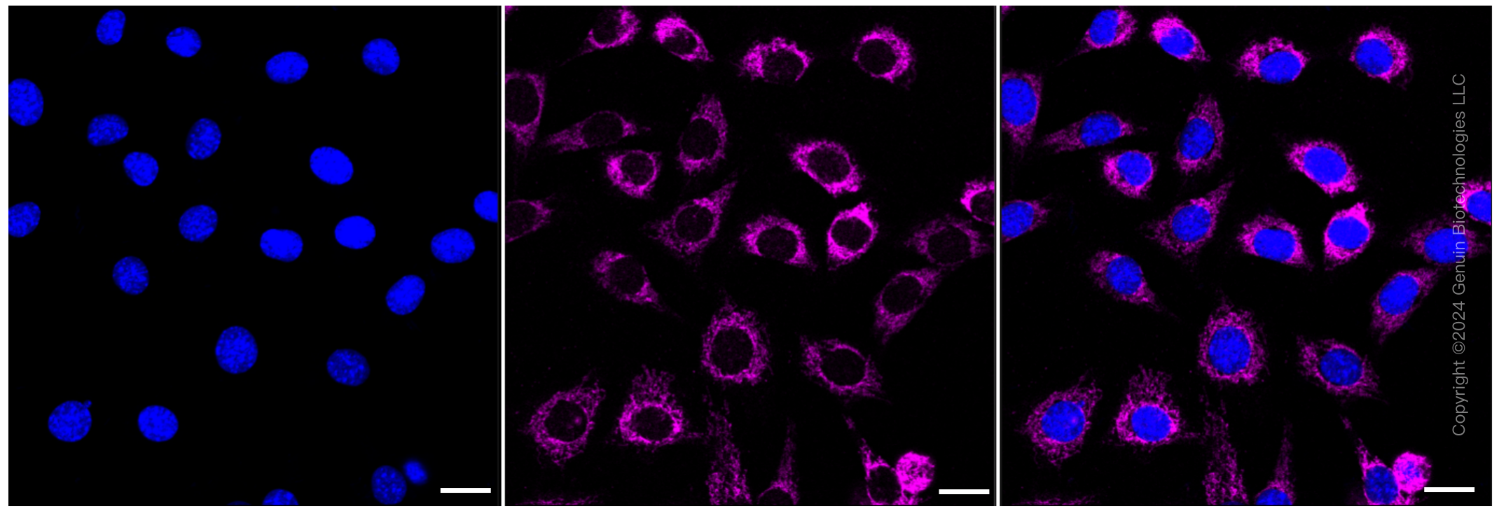 KD-Validated Anti-Acetyl-CoA acyltransfe rase 2 Rabbit Monoclonal Antibody ABG1304