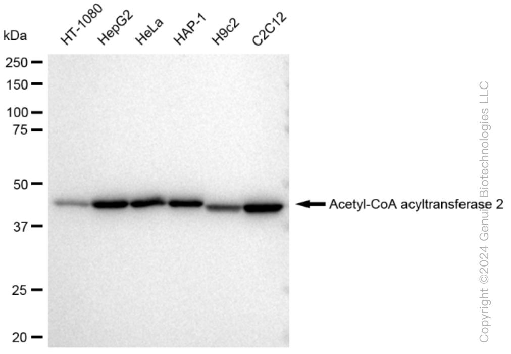 KD-Validated Anti-Acetyl-CoA acyltransfe rase 2 Rabbit Monoclonal Antibody ABG1304
