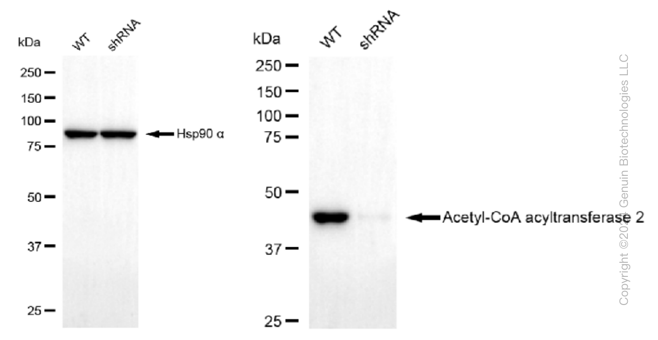KD-Validated Anti-Acetyl-CoA acyltransfe rase 2 Rabbit Monoclonal Antibody ABG1304