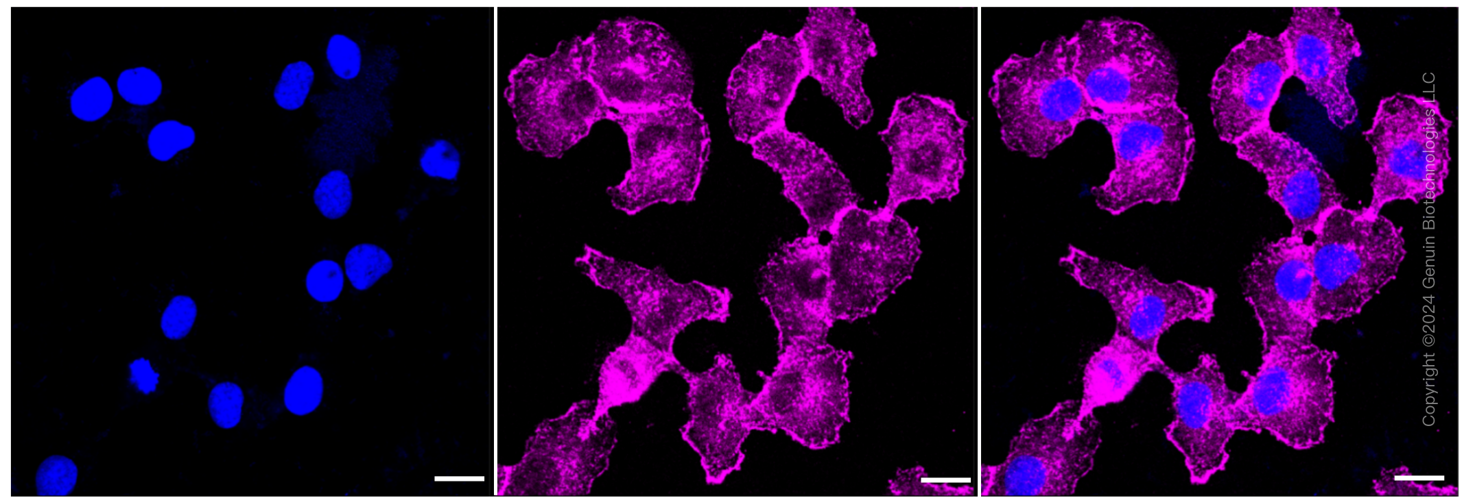 KD-Validated Anti-ARPC2 Rabbit Monoclonal Antibody ABG1306
