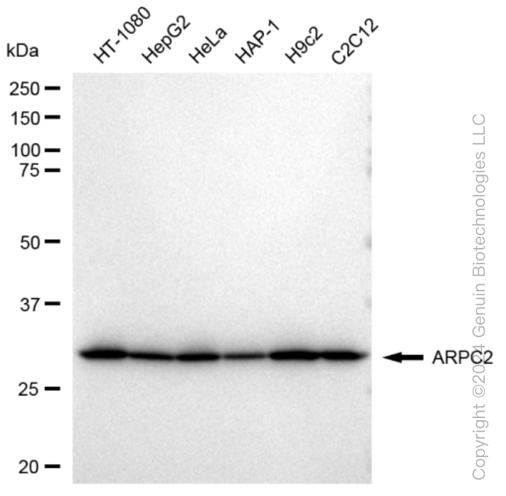 KD-Validated Anti-ARPC2 Rabbit Monoclonal Antibody ABG1306