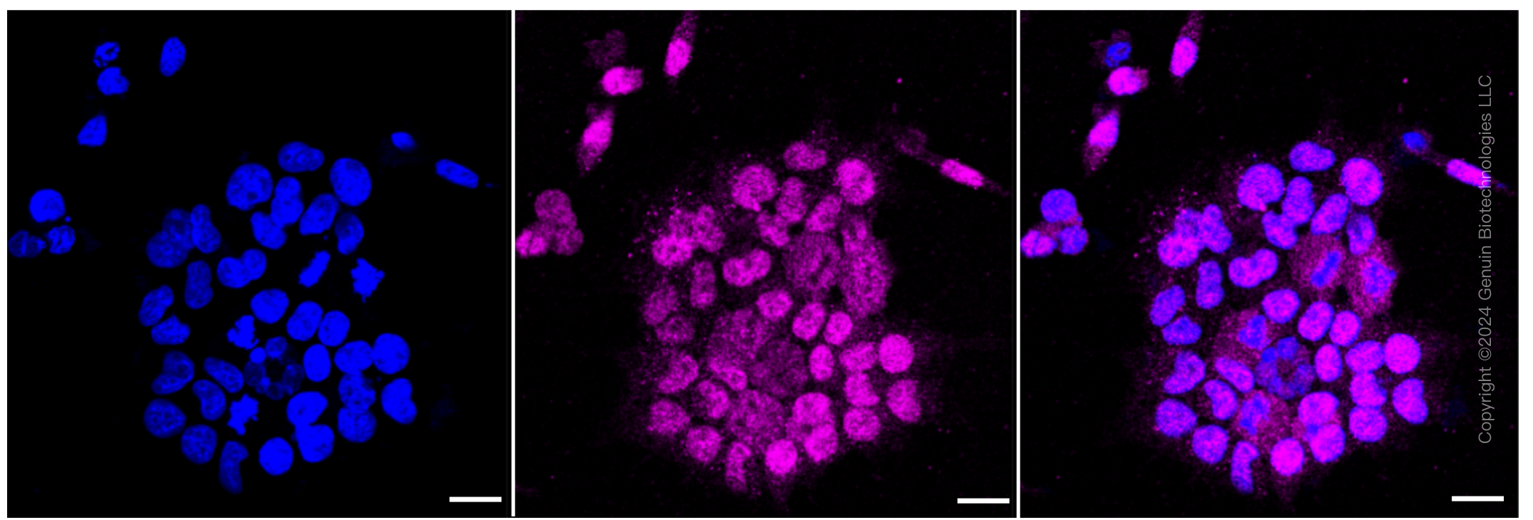 KD-Validated Anti-CLP1 Rabbit Monoclonal Antibody ABG1307