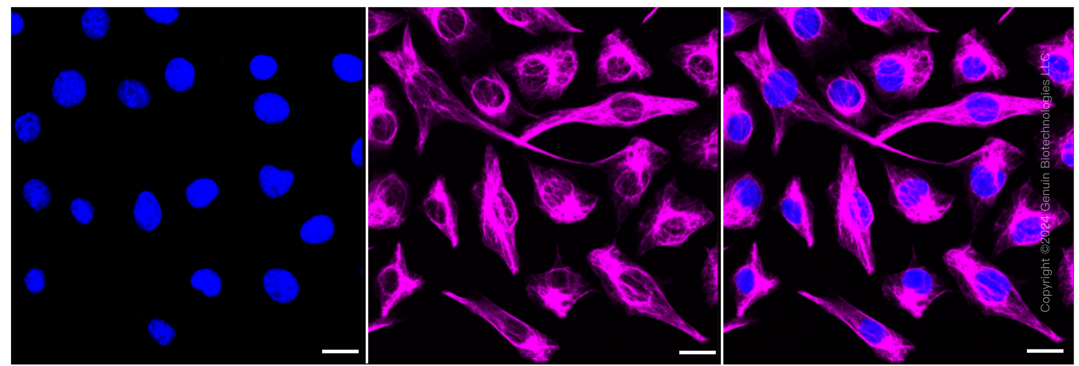 KD-Validated Anti-Desmin Rabbit Monoclonal Antibody ABG1308