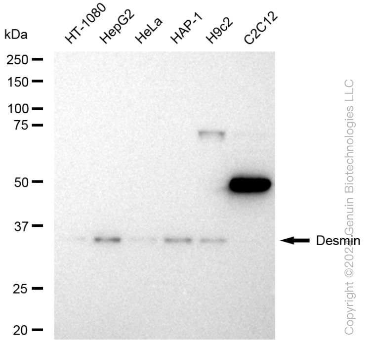 KD-Validated Anti-Desmin Rabbit Monoclonal Antibody ABG1308