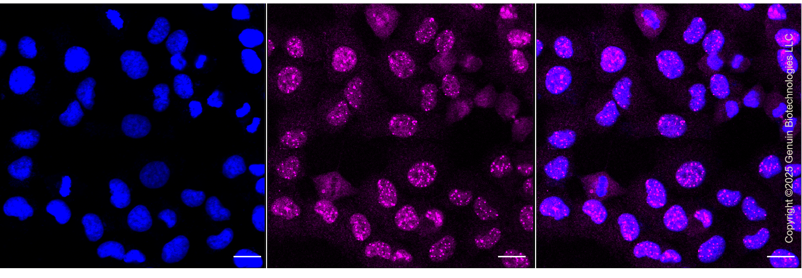 KD-Validated Anti-FLI1 Rabbit Monoclonal Antibody ABG1309