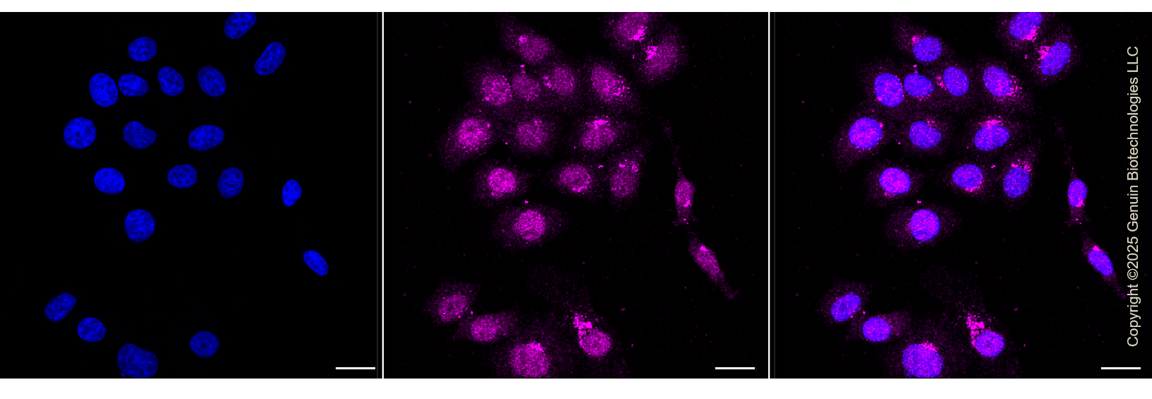 KD-Validated Anti-Checkpoint Kinase 1 Rabbit Monoclonal Antibody ABG1310