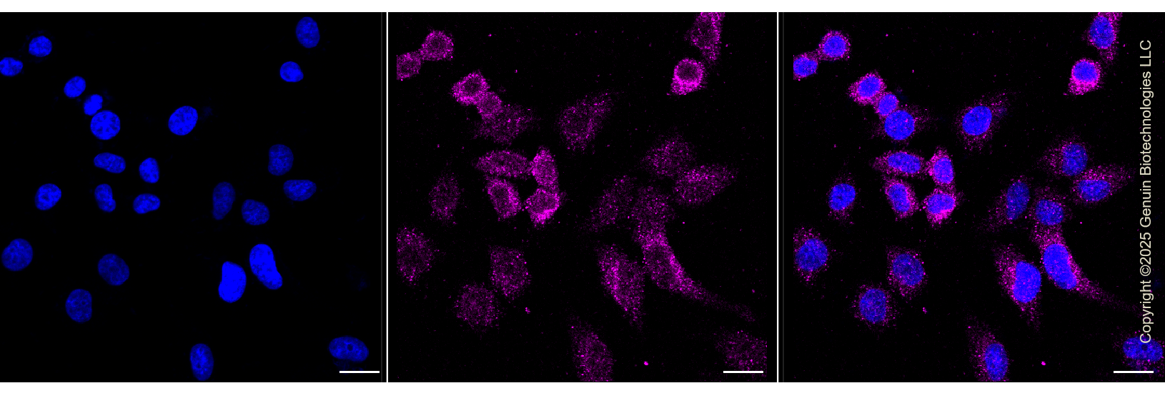 KD-Validated Anti-IKBKB Rabbit Monoclonal Antibody ABG1311