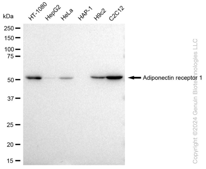 KD-Validated Anti-Adiponectin receptor 1 Rabbit Monoclonal Antibody ABG1312