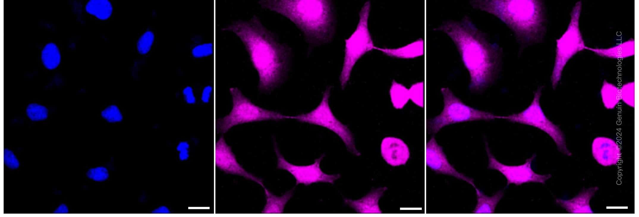 KD-Validated Anti-AKR1C1/AKR1C2 Rabbit Monoclonal Antibody ABG1313