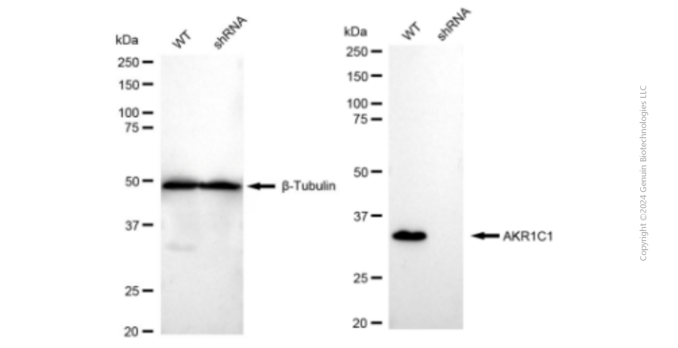 KD-Validated Anti-AKR1C1/AKR1C2 Rabbit Monoclonal Antibody ABG1313
