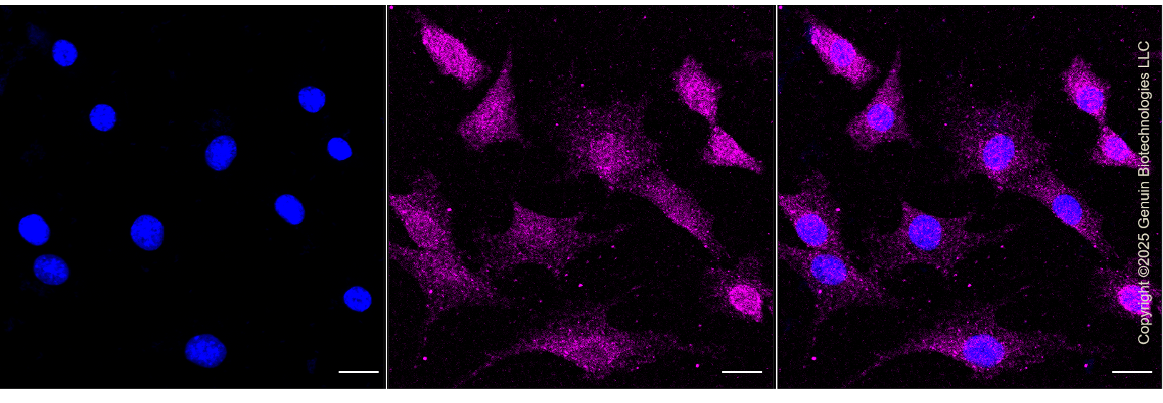 KD-Validated Anti-Integrin Linked Kinase Rabbit Monoclonal Antibody ABG1314