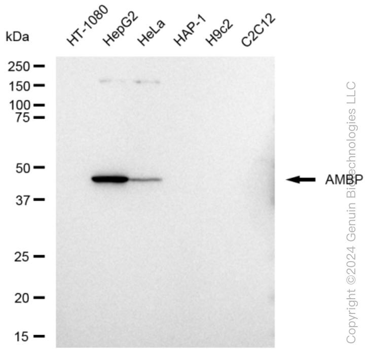 KD-Validated Anti-AMBP Rabbit Monoclonal Antibody ABG1315