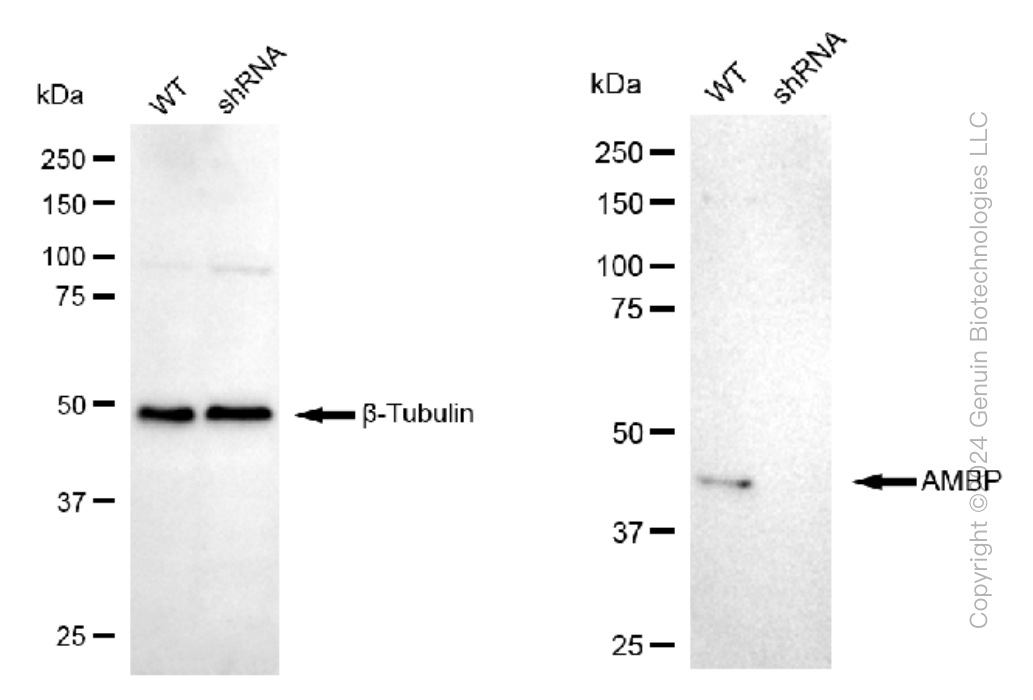 KD-Validated Anti-AMBP Rabbit Monoclonal Antibody ABG1315