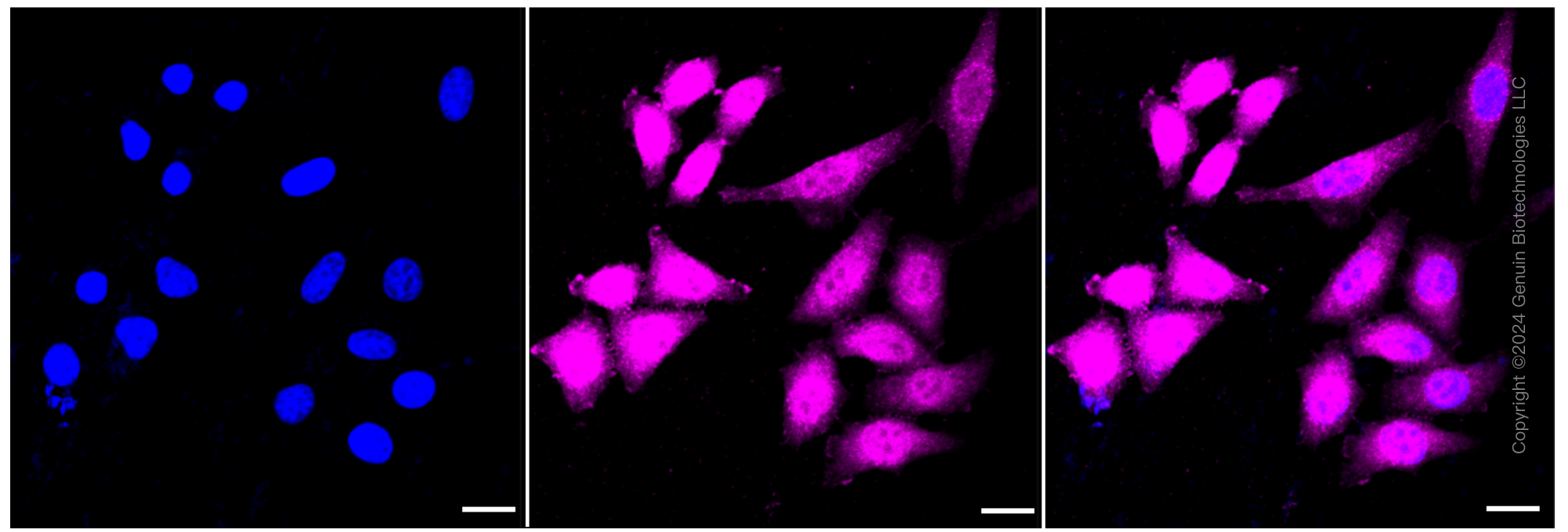 KD-Validated Anti-Annexin A10 Rabbit Monoclonal Antibody ABG1316