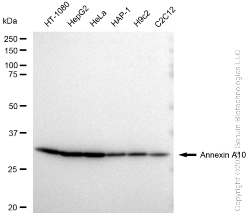 KD-Validated Anti-Annexin A10 Rabbit Monoclonal Antibody ABG1316