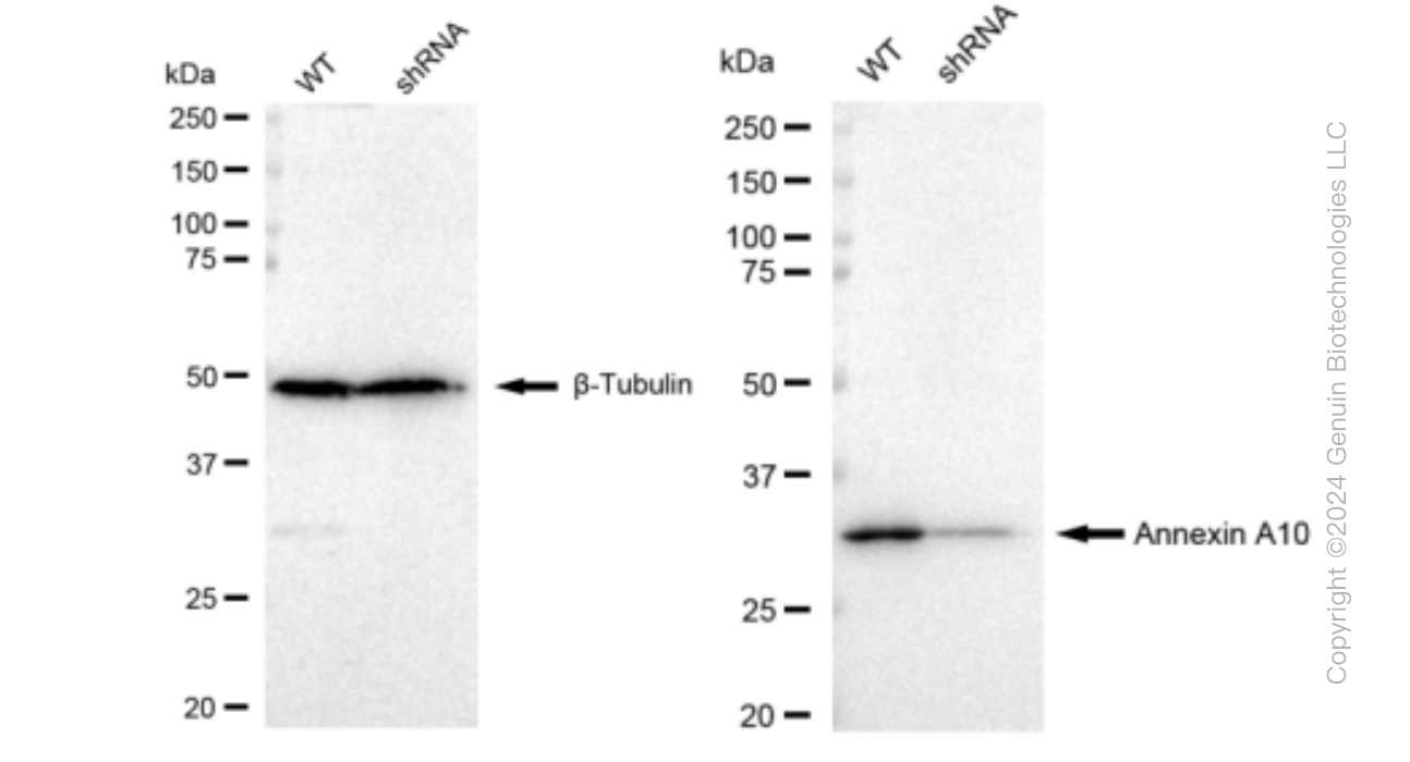 KD-Validated Anti-Annexin A10 Rabbit Monoclonal Antibody ABG1316