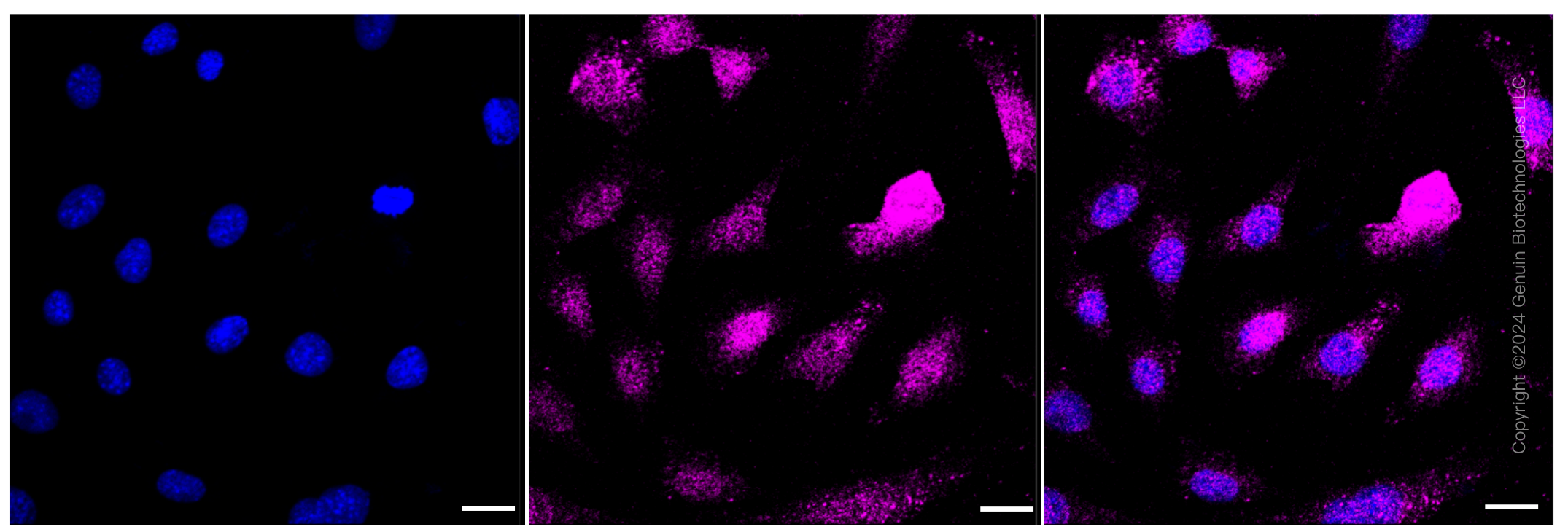 KD-Validated Anti-AP2M1 Rabbit Monoclonal Antibody ABG1317